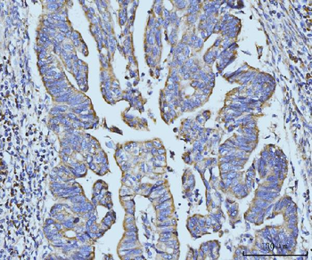 BZW2 Rabbit Polyclonal Antibody