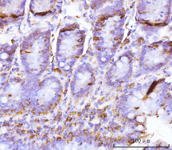 BZW2 Rabbit Polyclonal Antibody