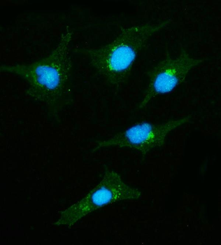 CLASP2 Rabbit Polyclonal Antibody