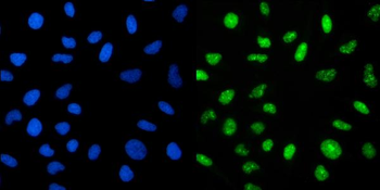 CRTC3 Rabbit Polyclonal Antibody