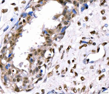 CRTC3 Rabbit Polyclonal Antibody