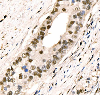CRTC3 Rabbit Polyclonal Antibody