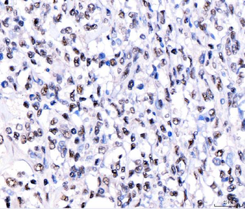 CRTC3 Rabbit Polyclonal Antibody