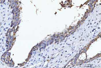 CYB5B Rabbit Polyclonal Antibody