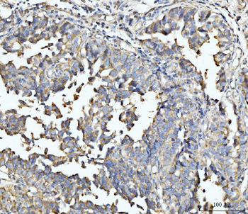 ECSIT Rabbit Polyclonal Antibody