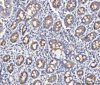 ECSIT Rabbit Polyclonal Antibody