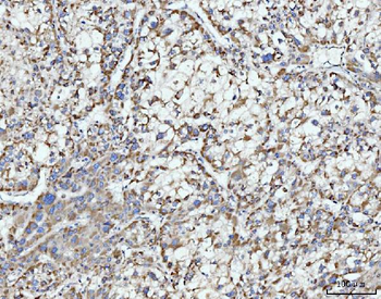ECSIT Rabbit Polyclonal Antibody
