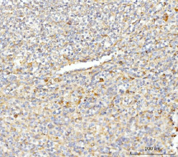 EIF3E Rabbit Polyclonal Antibody