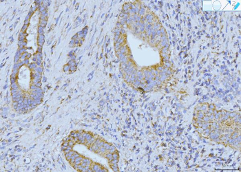 ETFA Rabbit Polyclonal Antibody