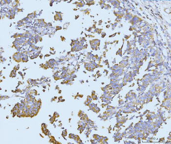 ETFA Rabbit Polyclonal Antibody