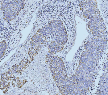 ETFA Rabbit Polyclonal Antibody