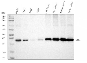 ETFA Rabbit Polyclonal Antibody