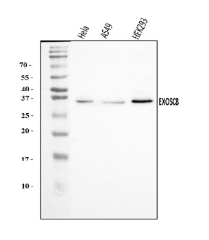 EXOSC8 Rabbit Polyclonal Antibody