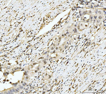 EXOSC8 Rabbit Polyclonal Antibody