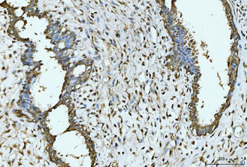 EXOSC8 Rabbit Polyclonal Antibody