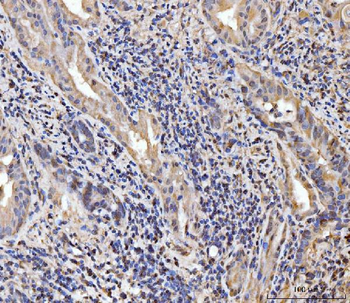 EXOSC8 Rabbit Polyclonal Antibody