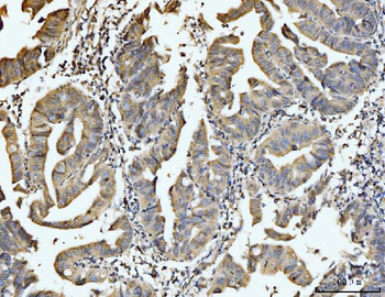 EXOSC8 Rabbit Polyclonal Antibody