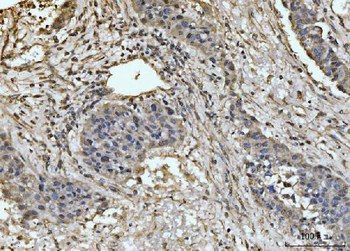 EXOSC8 Rabbit Polyclonal Antibody