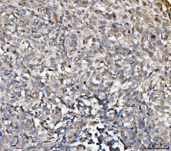 EXOSC8 Rabbit Polyclonal Antibody