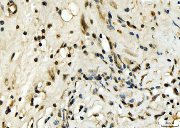 EXOSC8 Rabbit Polyclonal Antibody
