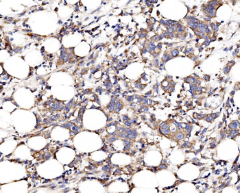 FKBP135/FKBP15 Rabbit Polyclonal Antibody