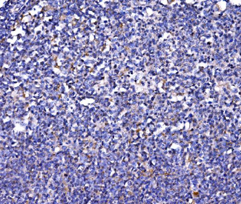 FKBP135/FKBP15 Rabbit Polyclonal Antibody