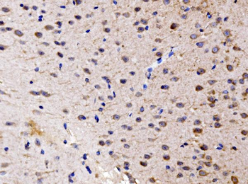 FKBP135/FKBP15 Rabbit Polyclonal Antibody