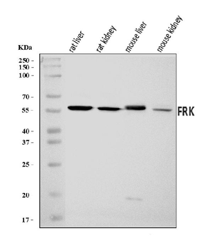 FRK Rabbit Polyclonal Antibody