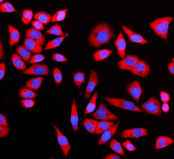 GIGYF2 Rabbit Polyclonal Antibody