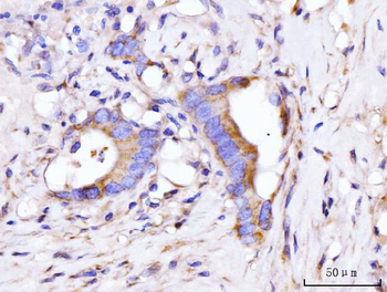GIGYF2 Rabbit Polyclonal Antibody