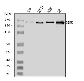 GIGYF2 Rabbit Polyclonal Antibody