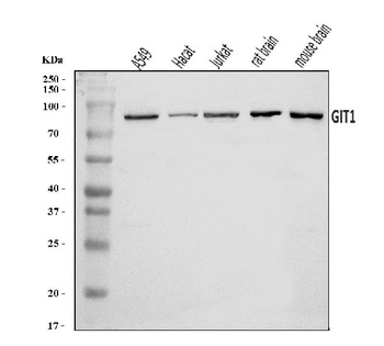 GIT1 Rabbit Polyclonal Antibody