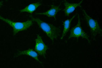 GIT1 Rabbit Polyclonal Antibody