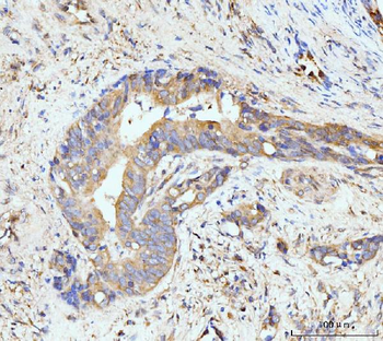 GIT1 Rabbit Polyclonal Antibody