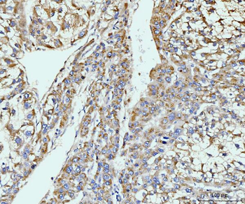 GIT1 Rabbit Polyclonal Antibody