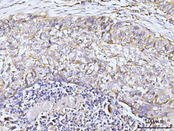 GIT1 Rabbit Polyclonal Antibody