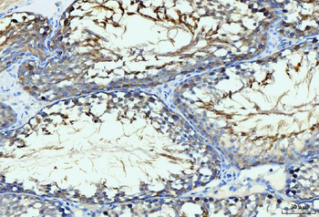 GIT1 Rabbit Polyclonal Antibody