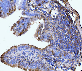 GLUL Rabbit Polyclonal Antibody