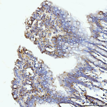 GLUL Rabbit Polyclonal Antibody