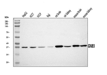 GNB3 Rabbit Polyclonal Antibody