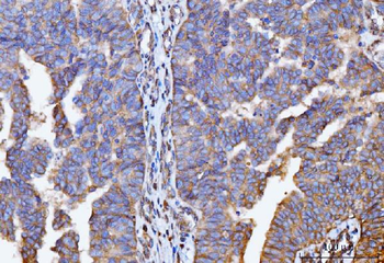 GNB3 Rabbit Polyclonal Antibody