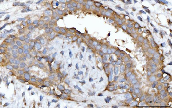 GNB3 Rabbit Polyclonal Antibody