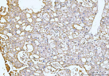 GNB3 Rabbit Polyclonal Antibody
