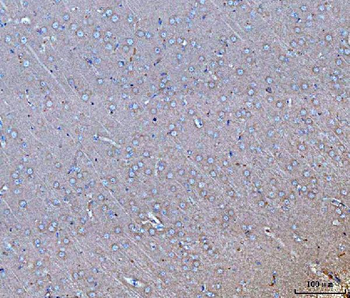 GNB3 Rabbit Polyclonal Antibody