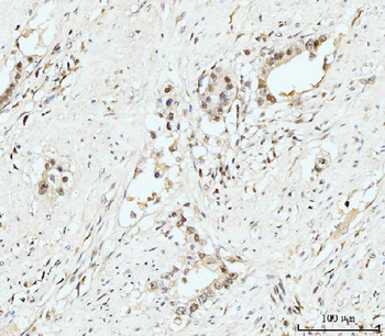 Nucleostemin/GNL3 Rabbit Polyclonal Antibody