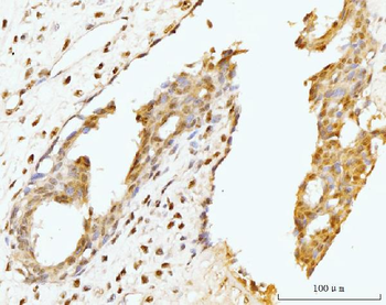 Nucleostemin/GNL3 Rabbit Polyclonal Antibody