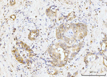 Nucleostemin/GNL3 Rabbit Polyclonal Antibody