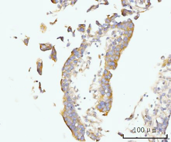 Golgin 97/GOLGA1 Rabbit Polyclonal Antibody