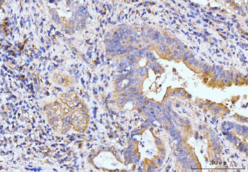 Golgin 97/GOLGA1 Rabbit Polyclonal Antibody