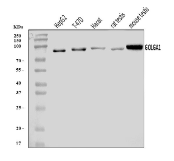 Golgin 97/GOLGA1 Rabbit Polyclonal Antibody